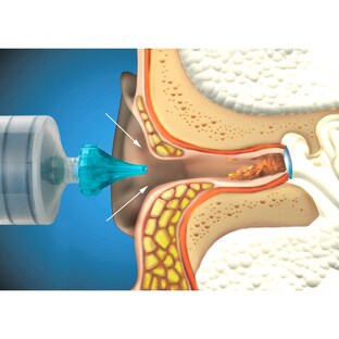 Ohrenwachs-Entfernungsspritze